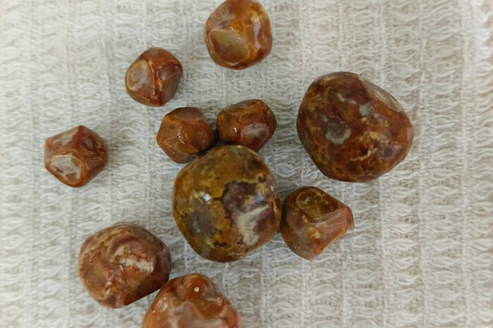 © ГУЗ СО «Балаковская городская клиническая больница»