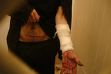 В тюремной больнице Балашова заключенные объявили голодовку и нанесли себе увечья в знак протеста против действий руководства. Инцидентом заинтересовался Совет по правам человека