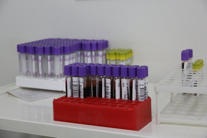 Министр рассказал, что на пике пандемии тесты на COVID-19 брали только у «тяжелых» пациентов