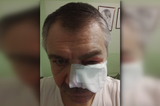 «Я догнал джип Toyota»: пенсионер рассказал о том, как гонки на Кумысной поляне закончились его жестоким избиением