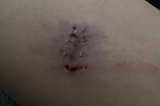 В Энгельсе бездомная собака напала на 12-летнего мальчика