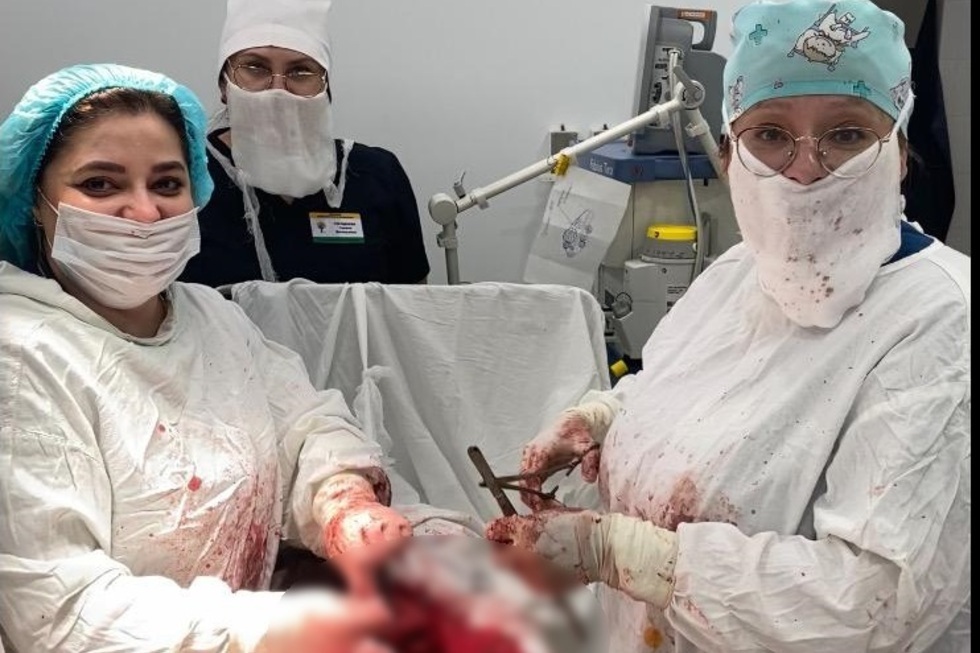 Саратовские врачи спасли молодую женщину с гигантской опухолью (фото не для слабонервных)