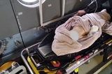 Ребенка с жуткими ожогами доставили в областную больницу на вертолете