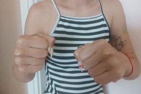 Сломанная челюсть, нос и ребра: женщина жестоко избила подругу по таинственной причине