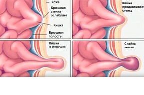«Врачи умоляют не терпеть»: балаковские медики рассказали о сложной операции 90-летней пациентки