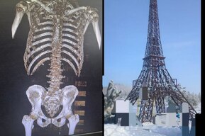 В один день мужчина увидел Тадж-Махал, статую Христа, и упал с Эйфелевой башни: врачи сначала не поверили, но это оказалось правдой