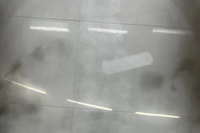 Врачи спасли двух детей, которые проглотили батарейки (у одного предмет успел опуститься в кишечник)