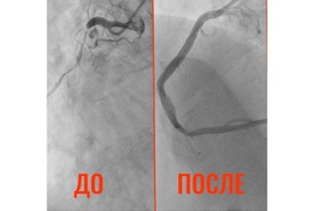К балаковским медикам пришёл пациент с «сердцем старика в 32 года»: история спасения