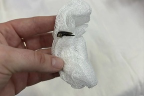 Годовалый ребёнок вдохнул «опасную вдвойне» семечку и терпел все выходные