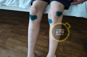 Жительница Балаково рассказала об избиении её 10-летнего сына в парке