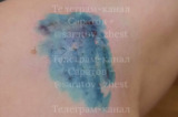 Прокусила ногу и порвала штаны: после нападения собаки на женщину на проспекте Энтузиастов возбудили уголовное дело 