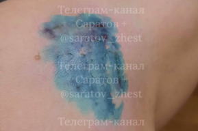 Прокусила ногу и порвала штаны: после нападения собаки на женщину на проспекте Энтузиастов возбудили уголовное дело 