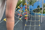 На площадке в сквере имени Марины Расковой, который «на достойном уровне» содержит специально созданная организация, травмировался ребёнок
