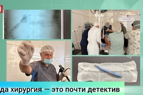 Врачи рассказали «детективную» историю мужчины, в которого регулярно попадают инородные тела