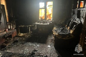 Сельчанин попал с ожогами в больницу, пытаясь потушить загоревшуюся веранду дома